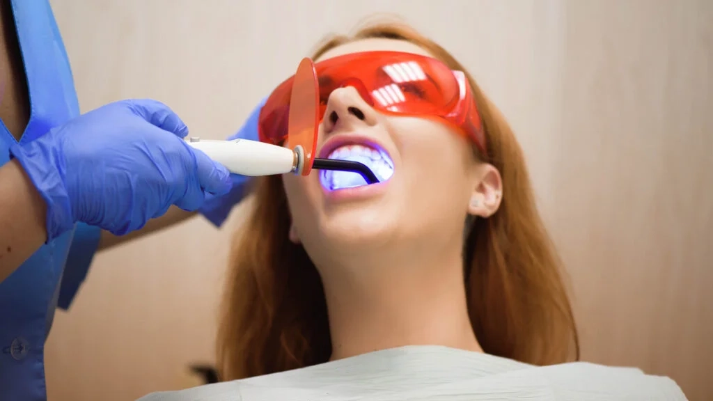 Teeth whitening