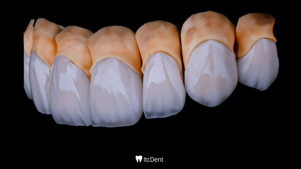 differences between Zirconium and Porcelain Veneers
