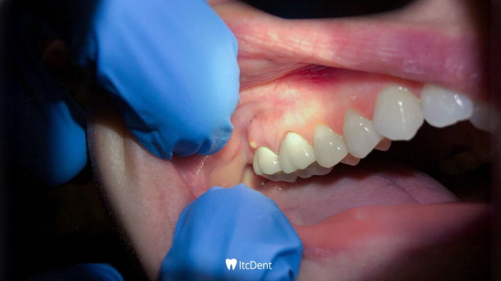 What is Dental Inflammation?