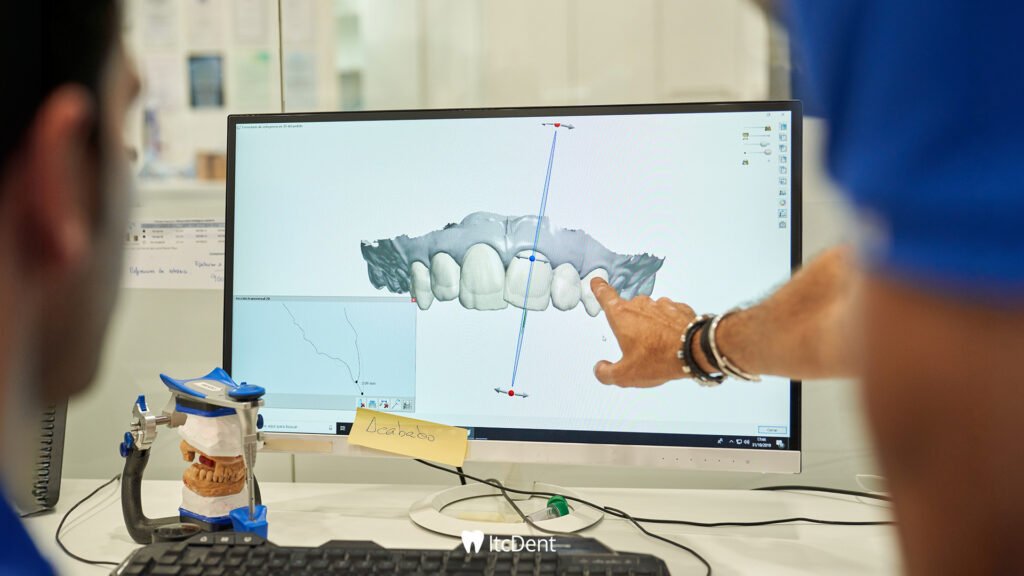 Dijital Ölçü Nedir