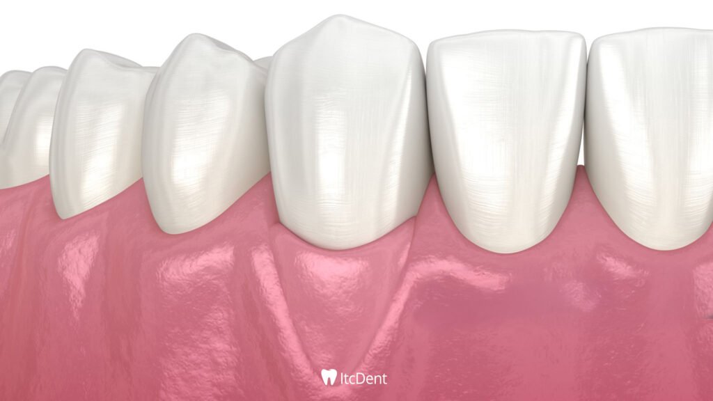 What Is Flap Surgery