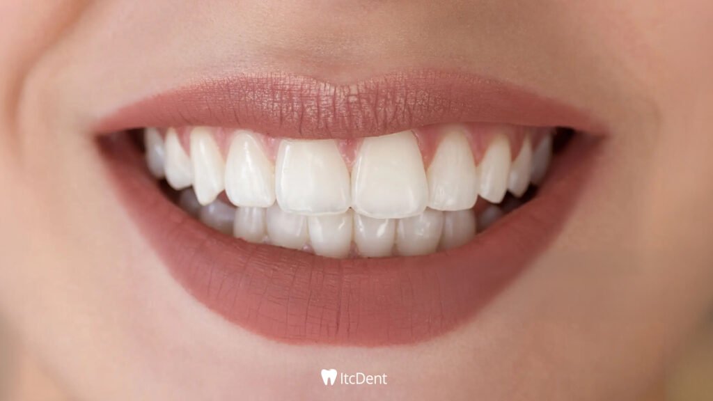 Diş Dolgusunun Ömrü Ne Kadardır?